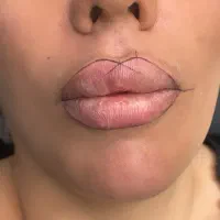 شیدینگ لب با هزینه فقط مواد تایم ویژه دوشنبه