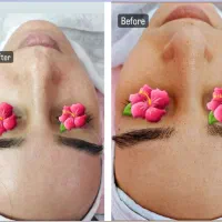 فیشال تخصصی پوست|خدمات آرایشگری و زیبایی|محمدشهر, محمدشهر|دیوار