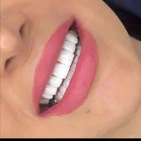 تخفیف کامپوزیت لمینت با اقساط|خدمات آرایشگری و زیبایی|قم, مهدیه|دیوار