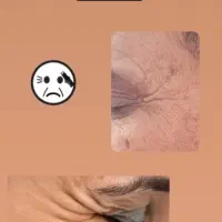 فشیال تخصصی تحت نظرپزشک..مشاوره مراقبت های پوست مو|خدمات آرایشگری و زیبایی|آبادان, |دیوار