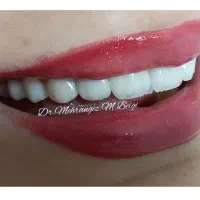 دندانپزشکی زیبایی و لمینت|خدمات آرایشگری و زیبایی|تهران, سلیمانی|دیوار