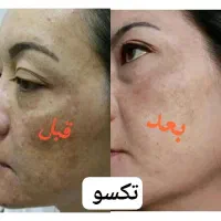 معجزه زیبایی با تکسو