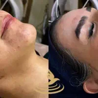 خدمات کاشت ناخن،فشیال صورت|خدمات آرایشگری و زیبایی|تبریز, |دیوار