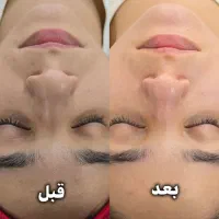 خدمات فیشیال و پاکسازی صورت
