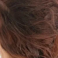 پاکسازی رشک و شپش