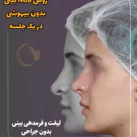 آف رینوپلاستی بینی بدون عمل جراحی NOA پزشک زیبایی|خدمات آرایشگری و زیبایی|مشهد, هفت تیر (آب و برق)|دیوار