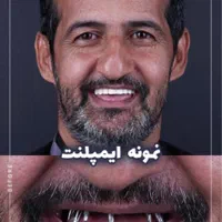 دندانپزشکی کامپوزیت لمینیت ایمپلنت بلیچینگ درمانی|خدمات آرایشگری و زیبایی|مشهد, سجاد شهر|دیوار