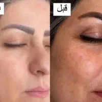 قوی ترین روشن کننده