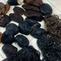 پروتز شنیون