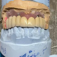 کارآموز خانم جهت دندانسازی