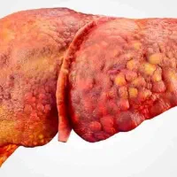 پاکسازی کبد در 21 روز