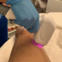 اپراتور لیزر آستخدام همراه با آموزش