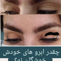 ریمو تخصصی تتوی صورت