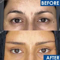 جشنواره بلفاروپلاستی و دیگر خدمات زیبایی|خدمات آرایشگری و زیبایی|کرمانشاه, |دیوار