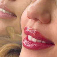 انجام تخصصی فیبرو و میکروبلیدینک وشیدلب|خدمات آرایشگری و زیبایی|شیراز, سیلو|دیوار