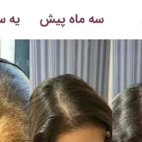 تونیک ضد ریزش هیرفرند|آرایشی، بهداشتی، درمانی|رشت, بلوار گیلان|دیوار