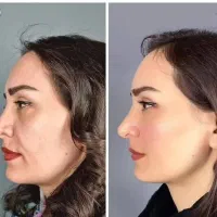 لاکچری کوین فرانسوی
