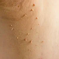 مشاوره تخصصی ویروس‌های خاص بدن (مشاوره محرمانه)