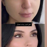 تخفیفات آنزیم بوتاکس صورت فیلر فول فیس و...|خدمات آرایشگری و زیبایی|مشهد, شهید فرامرز عباسی|دیوار