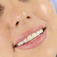 جشنواره ویژه کامپوزیت