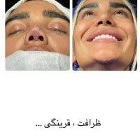 عمل بینی|خدمات آرایشگری و زیبایی|محمدشهر, محمدشهر|دیوار