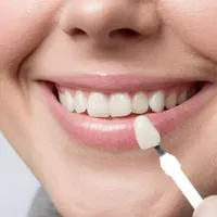 مدل برای انجام لمینت دندان|خدمات آرایشگری و زیبایی|تهران, فرمانیه|دیوار