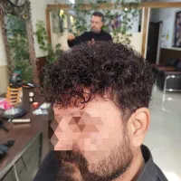 پروتز مو و کلاه‌گیس موی طبیعی