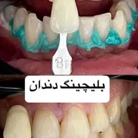 تخفیفات ۳۰ درصدی افتتاح مطب دندانپزشکی|خدمات آرایشگری و زیبایی|اهواز, کیانپارس |دیوار