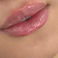 ژل بوتاکس بلفارو پلاستی لیزر|خدمات آرایشگری و زیبایی|اهواز, اهواز|دیوار