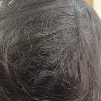 پاکسازی رشک وشپش