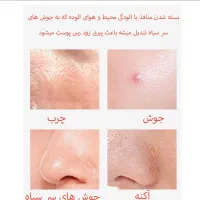 پاکسازی تخصصی پوست با متد درمانی نوین|خدمات آرایشگری و زیبایی|اهواز, شهرک برق|دیوار