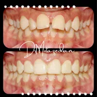 ارتودنسی و خدمات درمانی اقساطی بدون پیش پرداخت