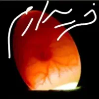 تخم عروس هلندی