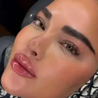 ژل لب خال مزوگونه زاویه خط خنده بوتاکس فقط 498