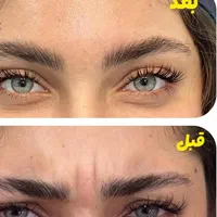 فیلر بادی ژل لب بوتاکس نخ لیفت فیلر بینی آنزیم لب|خدمات آرایشگری و زیبایی|اصفهان, باغ نگاره|دیوار