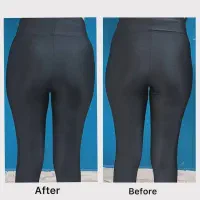 تخفیفات فیلر بادی ،بوتاکس،کانتورینگ توسط پزشک|خدمات آرایشگری و زیبایی|کرج, گوهردشت|دیوار