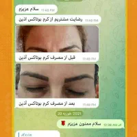 کرم بوتاکس حرفه ای آذین|آرایشی، بهداشتی، درمانی|شیراز, جانبازان|دیوار