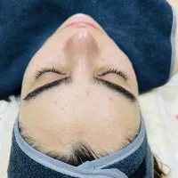فیشیال  و پاکسازی صورت