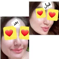 لاغری فقط فقط با عسل|خوردنی و آشامیدنی|دلگان, |دیوار