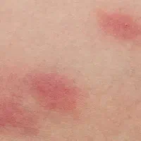 سمپاشی۱۰۰٪تضمینی کل حشرات ساس سوسک و..تهران و حومه|خدمات نظافت|تهران, سلسبیل شمالی|دیوار