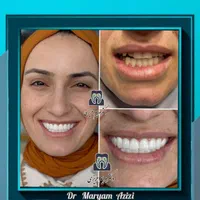 دندانپزشکی زیبایی و درمانی لمینت کامپوزیت دندان|خدمات آرایشگری و زیبایی|شیراز, معالی‌آباد|دیوار