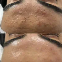 آموزش تخصصی فیشال با 50 درصد تخفیف به مدت محدود