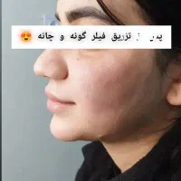 خدمات زیبایی تزریق فیلر ،بوتاکس و لیزر در مطب پزشک|خدمات آرایشگری و زیبایی|قم, نیروگاه|دیوار