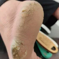 اسپا و خدمات زیبایی.تخفیف