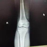 مشاوره در امور جراحی