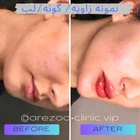 همکاری با مترجم**عربی زبان**در حوزه زیبایی پزشکی|استخدام بازاریابی و فروش|اصفهان, مرداویج|دیوار