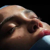 جوان سازی لیفت و خدمات زیبایی حرفی