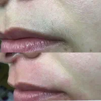 خدمات اصلاح ابرو و صورت|خدمات آرایشگری و زیبایی|اصفهان, کساره|دیوار