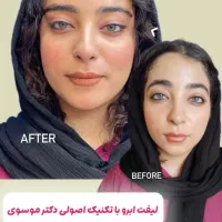 مرکز تخصصی تزریق فول فیس چربی و فیلر/لیفت با نخ|خدمات آرایشگری و زیبایی|مشهد, هنرستان|دیوار