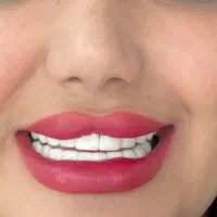 افر ویژه کامپوزیت دندان مواد تضمینی و اصلی|خدمات آرایشگری و زیبایی|کرج, گوهردشت|دیوار